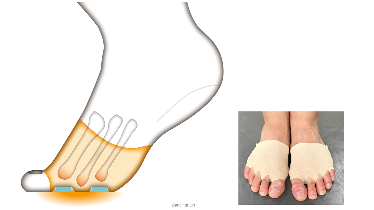 IKATARSAL Foot Supporter